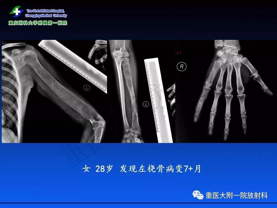 侬本痴情 推荐视频