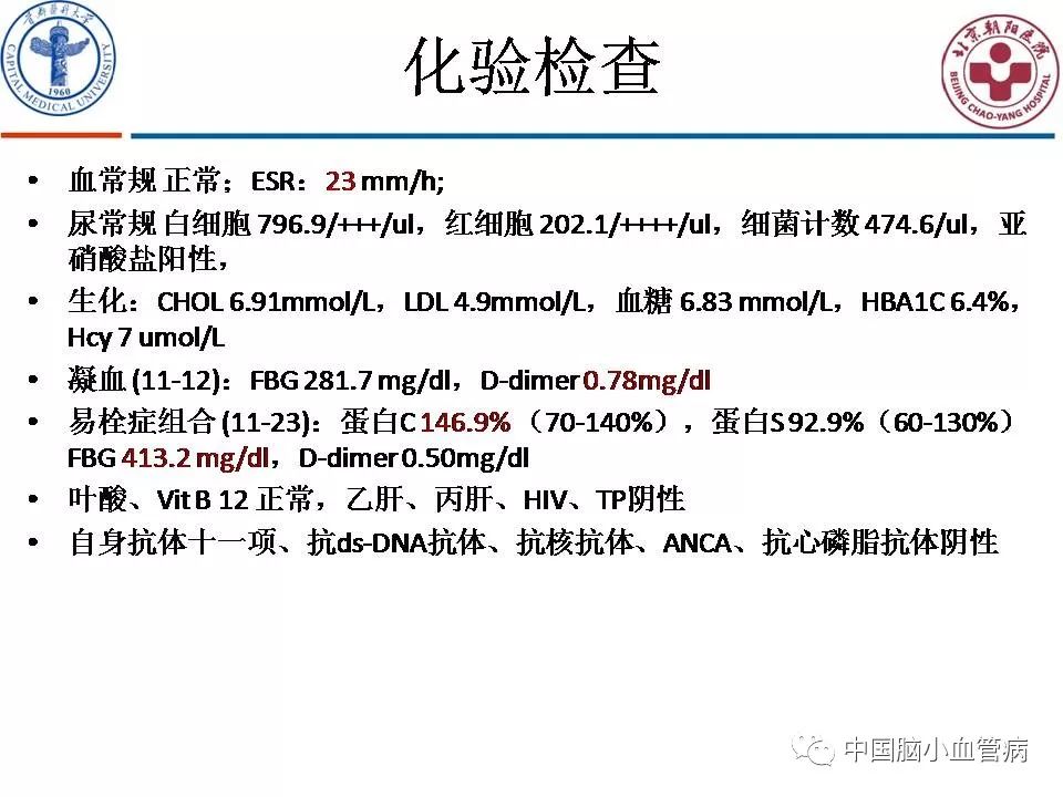 伊沃克人：为恩多而战 推荐视频