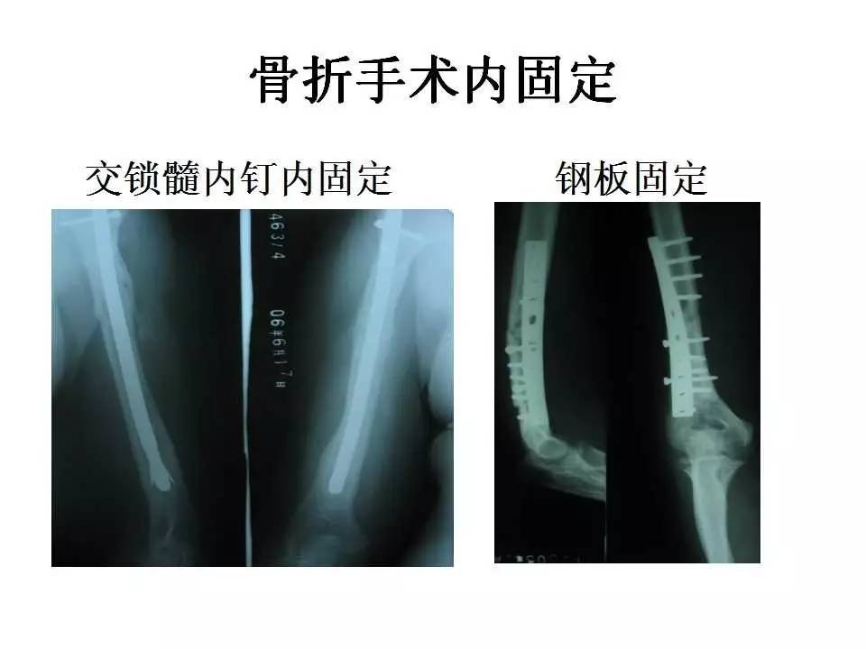 假面骑士×假面骑士 铠武 产品图片